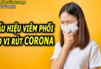 3-dau-hieu-dac-trung-can-phai-nho