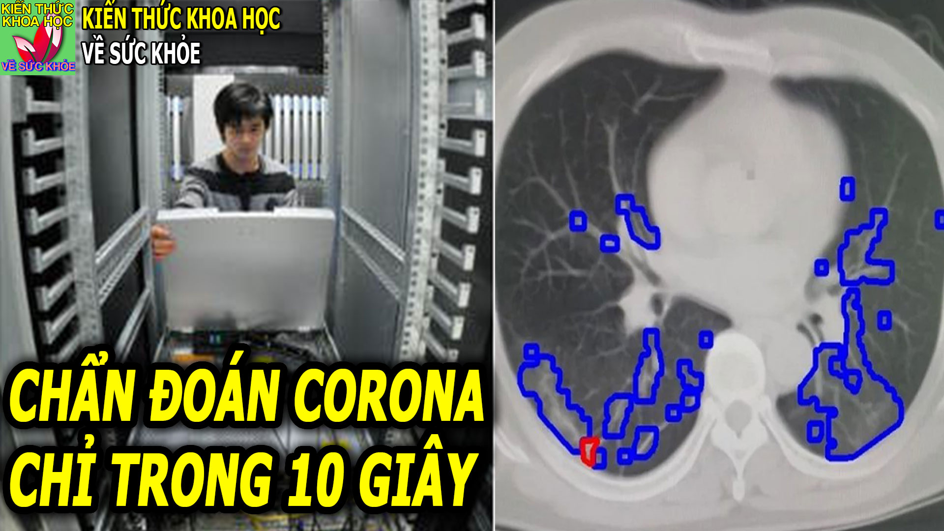 chan-doan-co-vy-chi-trong-10-giay-nho-tri-tue-nhan-tao