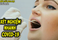 thiet-bi-phat-hien-co-vy-cho-ket-qua-chi-sau-5-phut