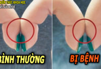 tu-phat-hien-som-ung-thu-phoi-nho-bai-kiem-tra-don-gian-nay