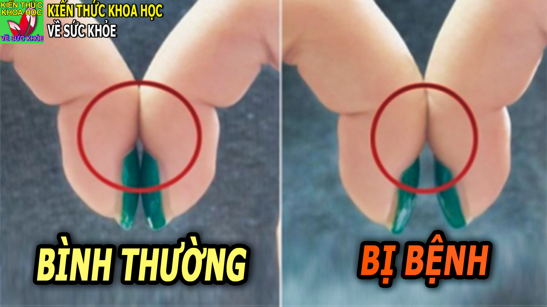 tu-phat-hien-som-ung-thu-phoi-nho-bai-kiem-tra-don-gian-nay