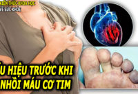 dau-hieu-trieu-chung-truoc-khi-bi-nhoi-mau-co-tim