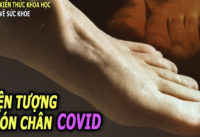 trieu-chung-la-xuat-hien-o-ngon-chan