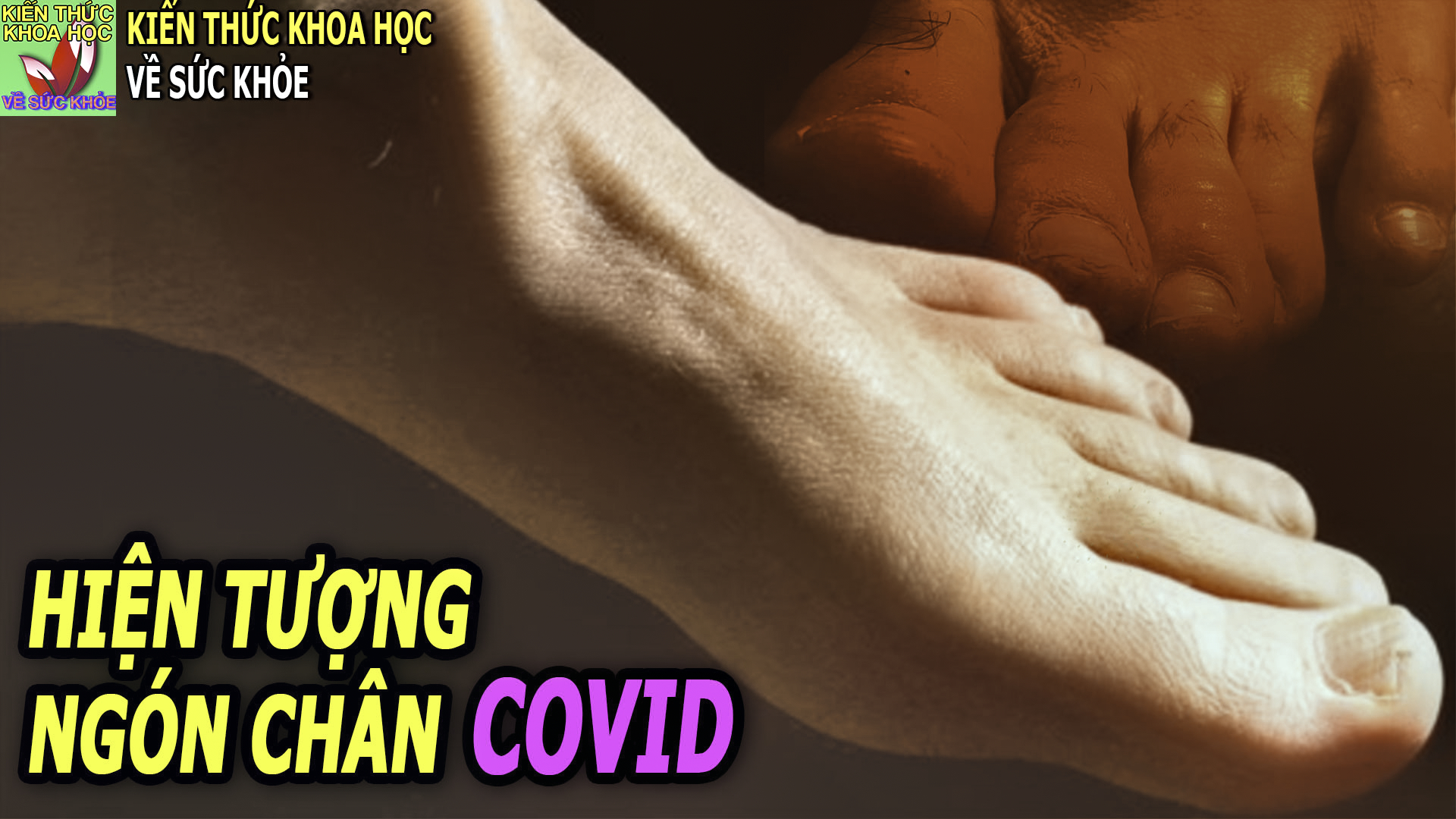 trieu-chung-la-xuat-hien-o-ngon-chan