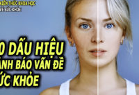 10-thay-doi-bat-thuong-tren-co-the-canh-bao-van-de-suc-khoe-tiem-an