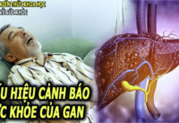 6-dau-hieu-cho-thay-gan-dang-dan-suy-yeu