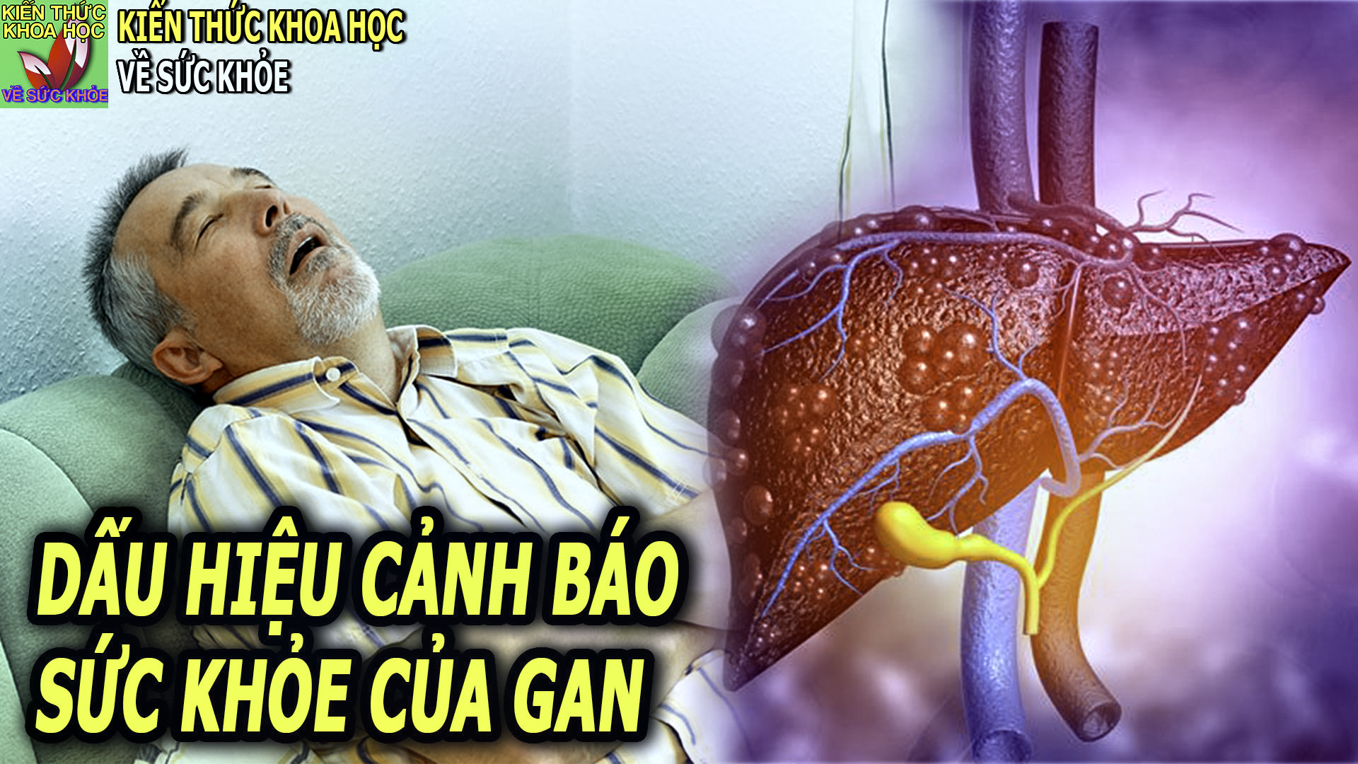 6-dau-hieu-cho-thay-gan-dang-dan-suy-yeu