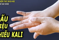 8-dau-hieu-o-nguoi-bi-thieu-kali