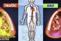 8-loai-thuc-pham-giup-lam-sach-mach-mau-thong-tac-dong-mach