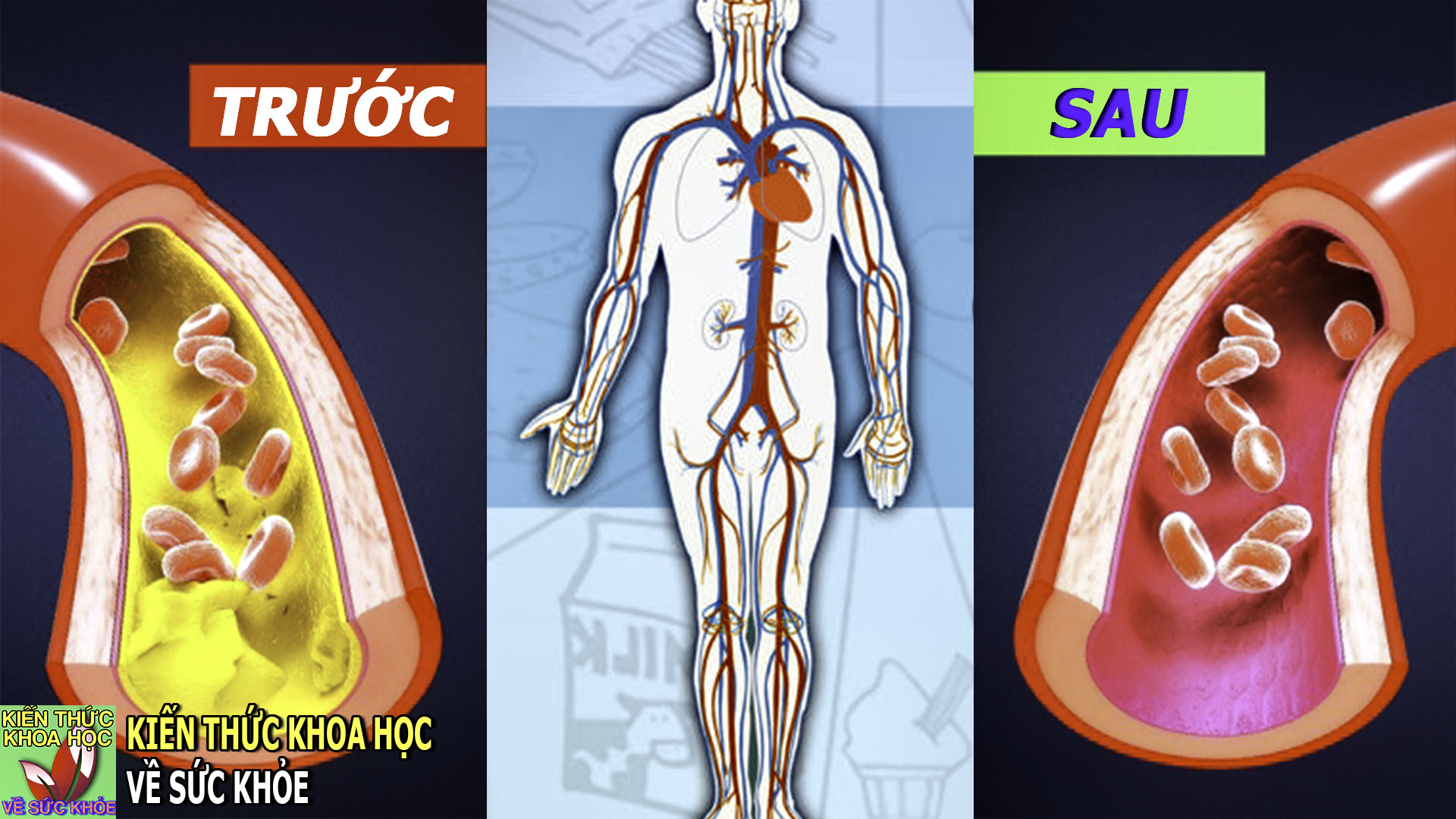 8-loai-thuc-pham-giup-lam-sach-mach-mau-thong-tac-dong-mach