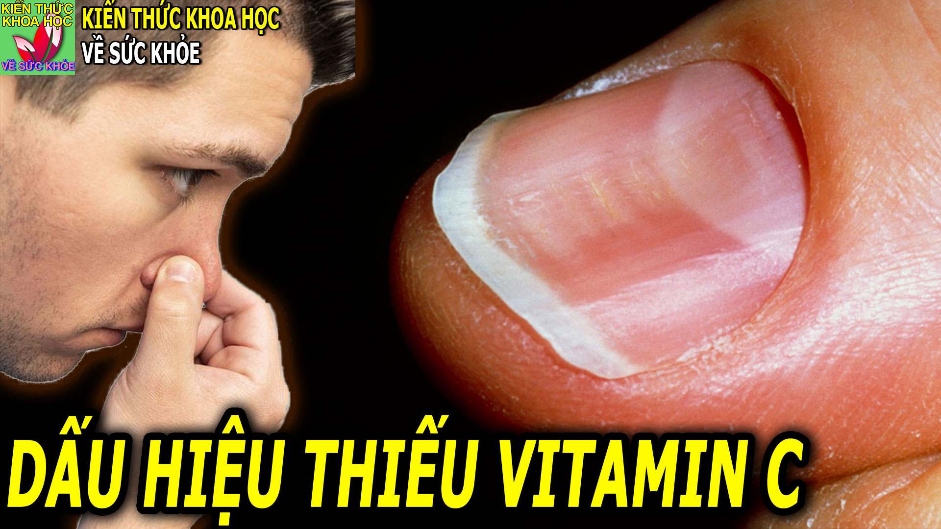 9-dau-hieu-o-nguoi-bi-thieu-vitamin-c