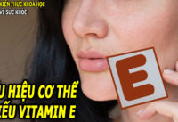 dau-hieu-bieu-hien-o-nguoi-bi-thieu-vitamin-e