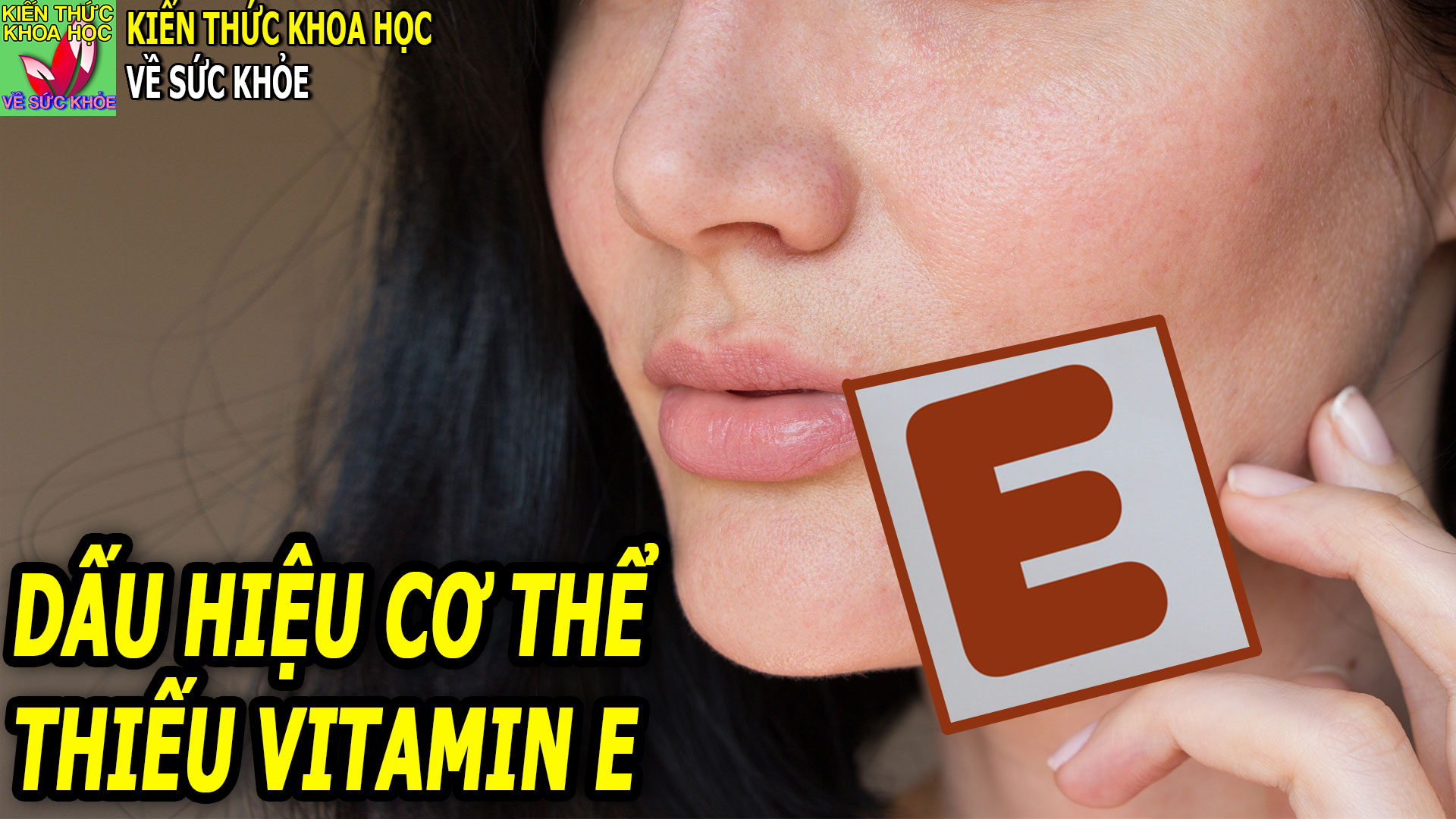 dau-hieu-bieu-hien-o-nguoi-bi-thieu-vitamin-e