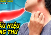 7-dau-hieu-o-nguoi-bi-ung-thu-tuyen-tuy