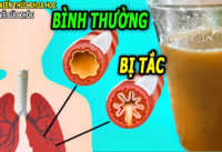 lam-sach-duong-ho-hap-tang-cuong-mien-dich-chi-1-coc-moi-ngay