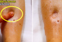 an-muoi-qua-nhieu-dieu-gi-se-xay-ra-voi-co-the-ban