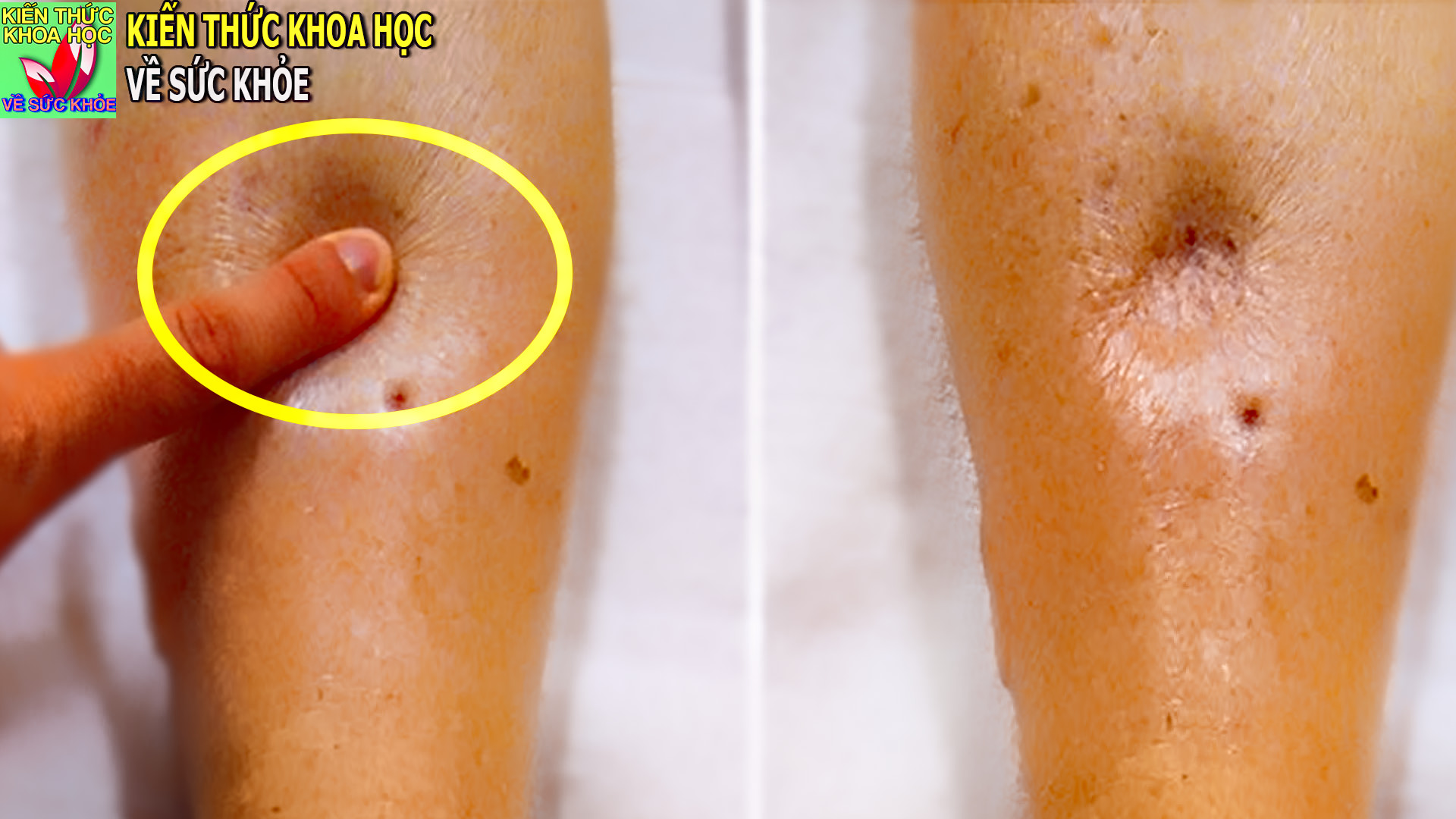 an-muoi-qua-nhieu-dieu-gi-se-xay-ra-voi-co-the-ban