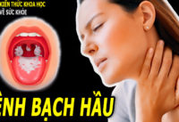 benh-bach-hau-la-gi-tim-hieu-ve-benh-bach-hau