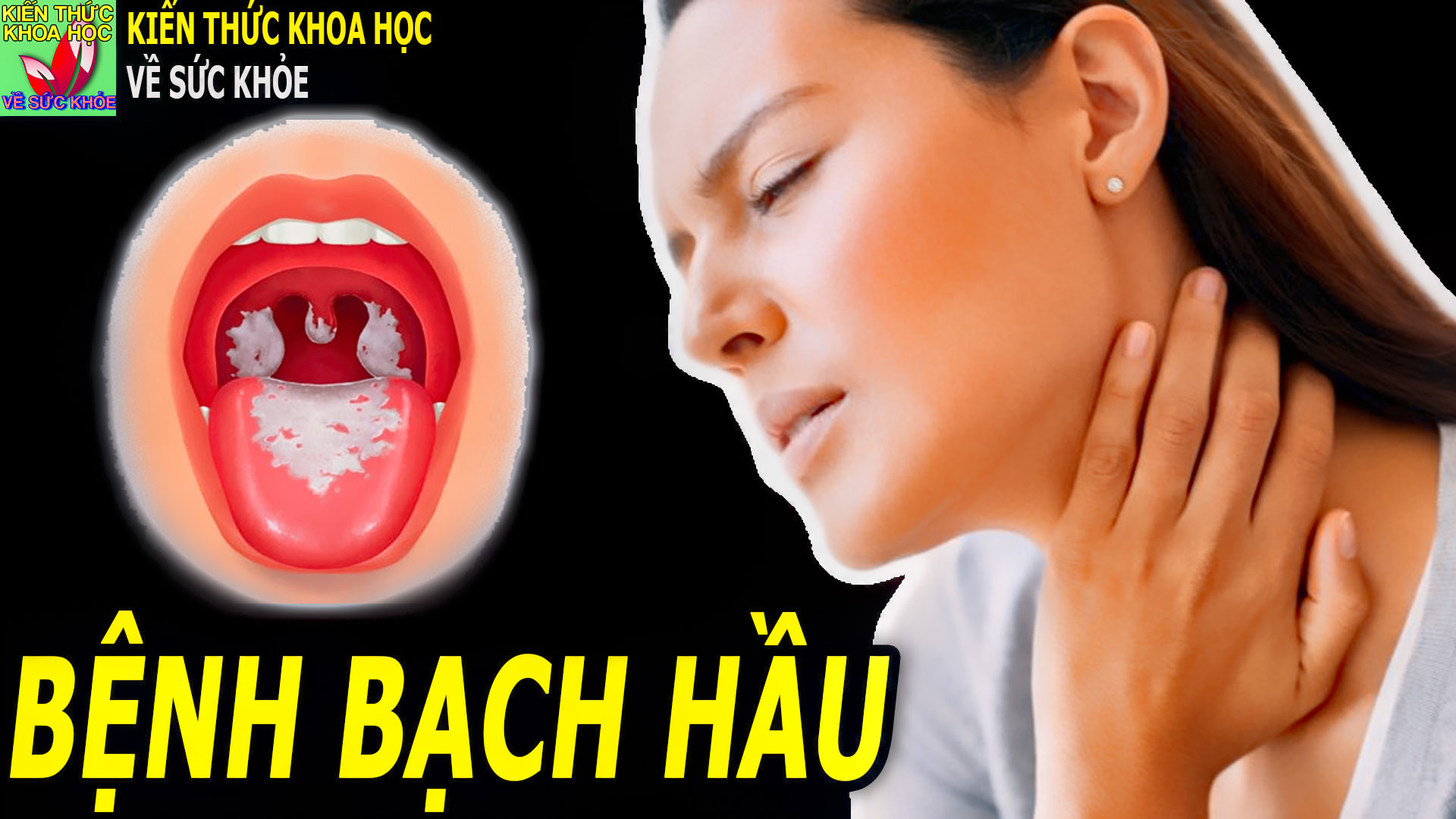 benh-bach-hau-la-gi-tim-hieu-ve-benh-bach-hau