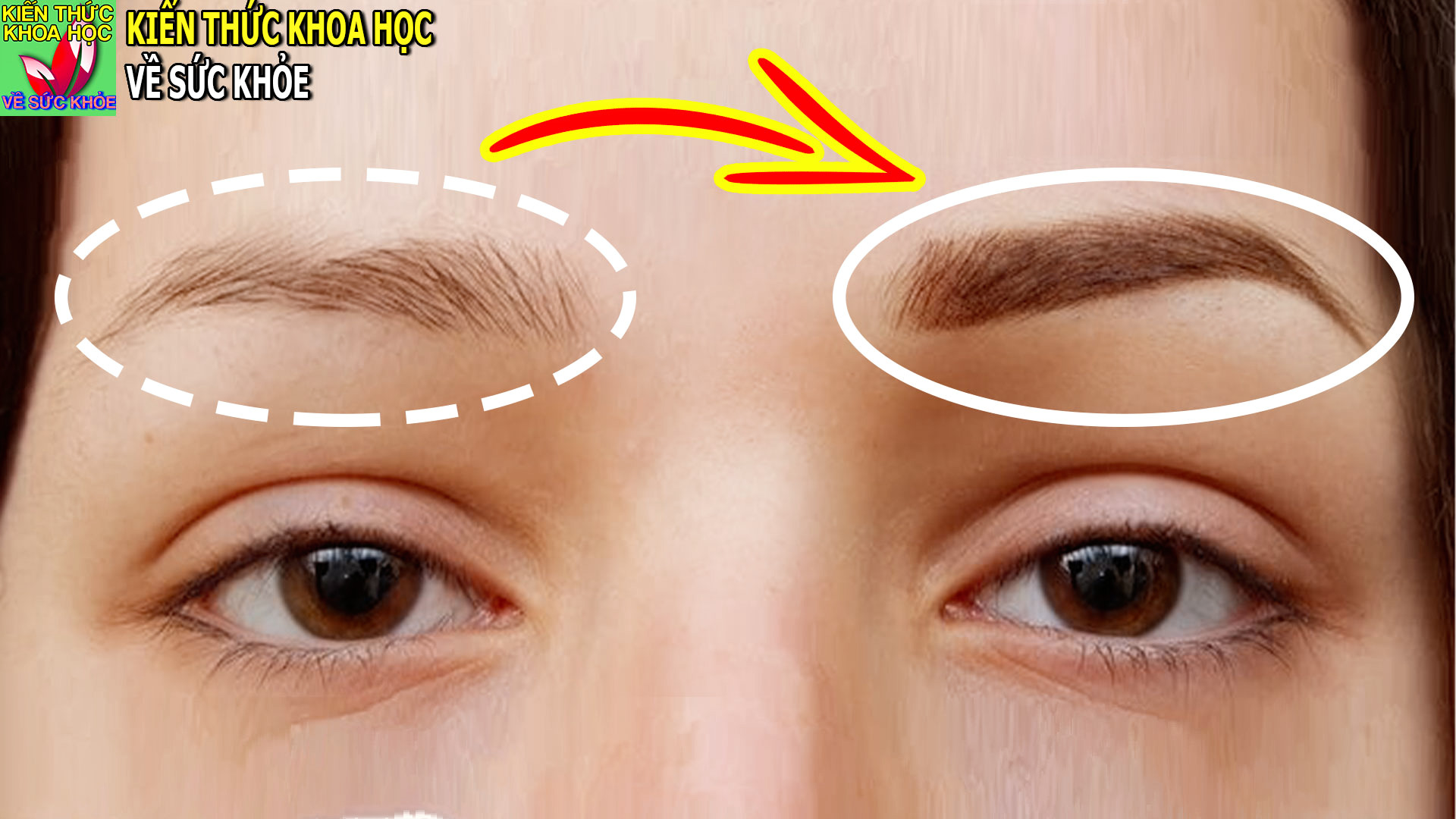 cach-lam-long-may-moc-nhanh-ram-day-tu-nhien