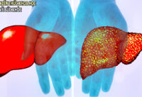 gan-met-moi-xuong-suc-cung-vi-4-loai-thuc-pham-nay
