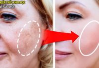 xoa-tan-nam-da-tan-nhang-mot-cach-tu-nhien-ngay-tai-nha