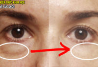 xoa-tan-quang-tham-va-bong-mat-chi-voi-2-nguyen-lieu-san-co-trong-nha-bep