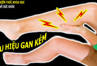 4-dau-hieu-khi-ngu-canh-bao-suc-khoe-cua-gan-co-van-de