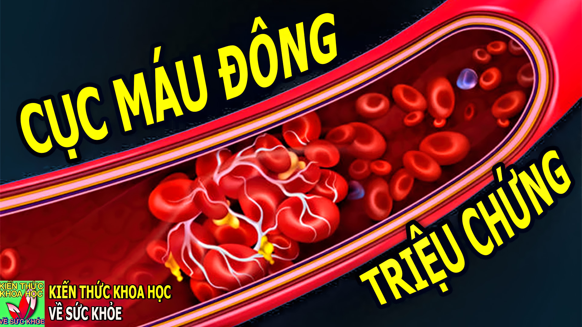 7-dau-hieu-trieu-chung-cua-cuc-mau-dong-ai-cung-nen-biet-som