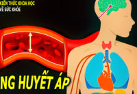 benh-tang-huyet-ap-cho-nen-xem-thuong