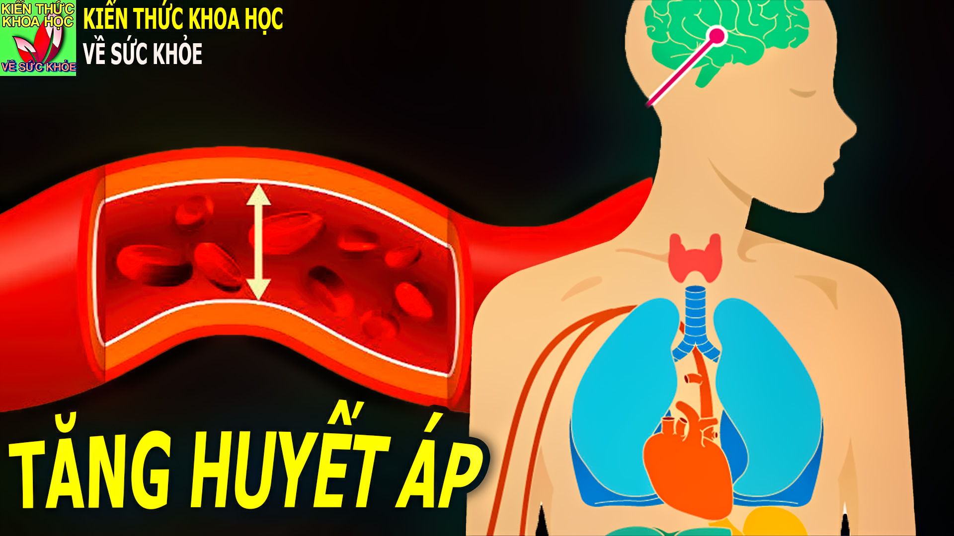 benh-tang-huyet-ap-cho-nen-xem-thuong