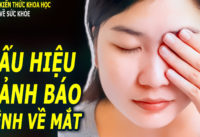 di-kham-mat-cang-som-cang-tot-neu-xuat-hien-nhung-dau-hieu-nay