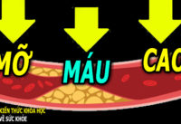 mo-mau-bao-nhieu-la-cao