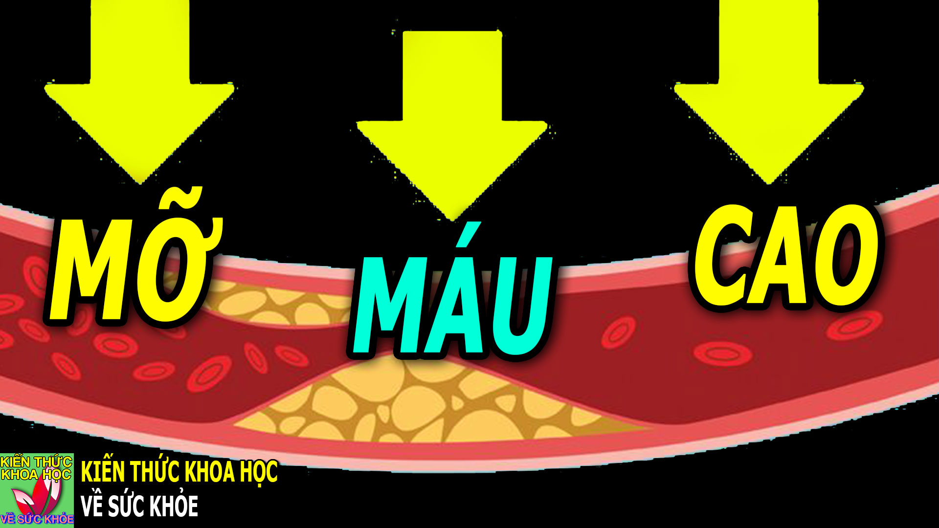 mo-mau-bao-nhieu-la-cao