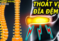 thoat-vi-dia-dem-nhung-dieu-can-nen-biet-som