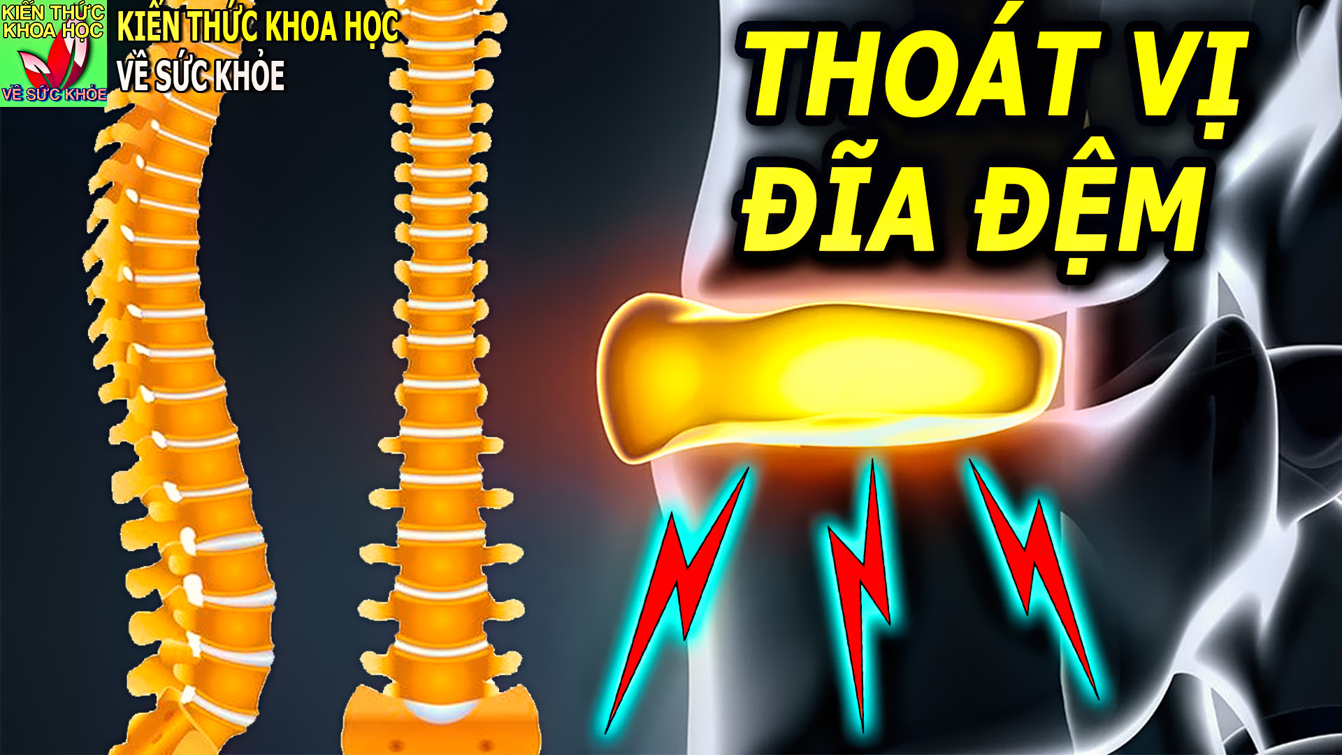 thoat-vi-dia-dem-nhung-dieu-can-nen-biet-som