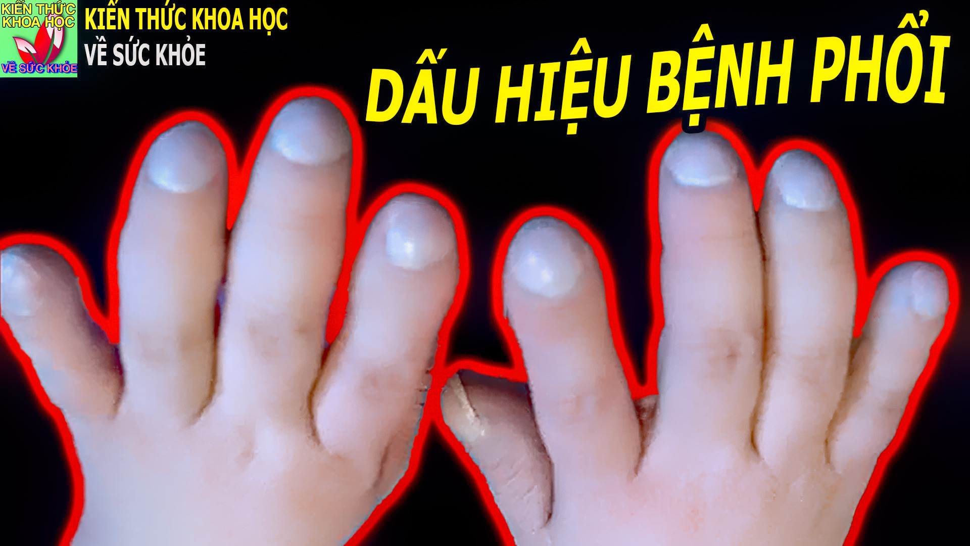 dau-hieu-canh-bao-nguoi-mac-benh-phoi