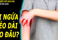 ngua-ngay-keo-dai-can-than-benh-trong