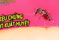 sot-xuat-huyet-co-bieu-hien-trieu-chung-gi