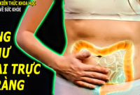 ung-thu-dai-truc-trang-dang-ngay-cang-tre-hoa