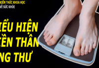 4-bieu-hien-cua-co-the-thuong-la-tien-than-cua-ung-thu