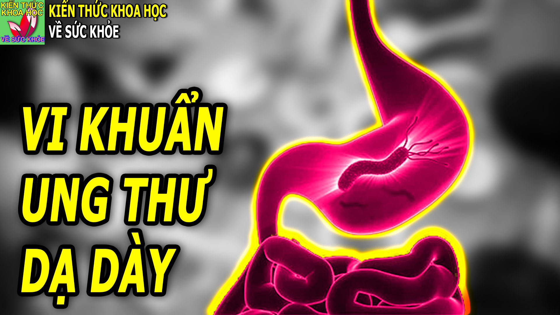 loai-vi-khuan-gay-ung-thu-da-day-de-lay-qua-bua-an
