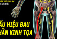 phan-biet-dau-than-kinh-toa-voi-dau-lung-thong-thuong