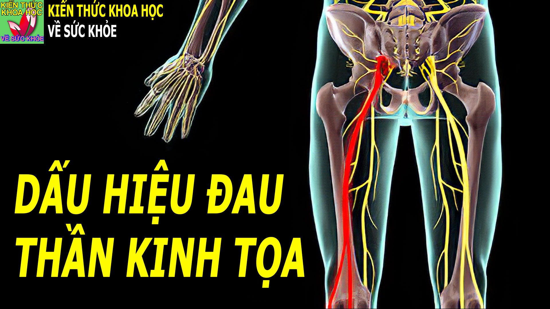 phan-biet-dau-than-kinh-toa-voi-dau-lung-thong-thuong