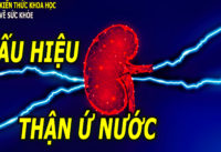 phat-hien-som-than-bi-u-nuoc