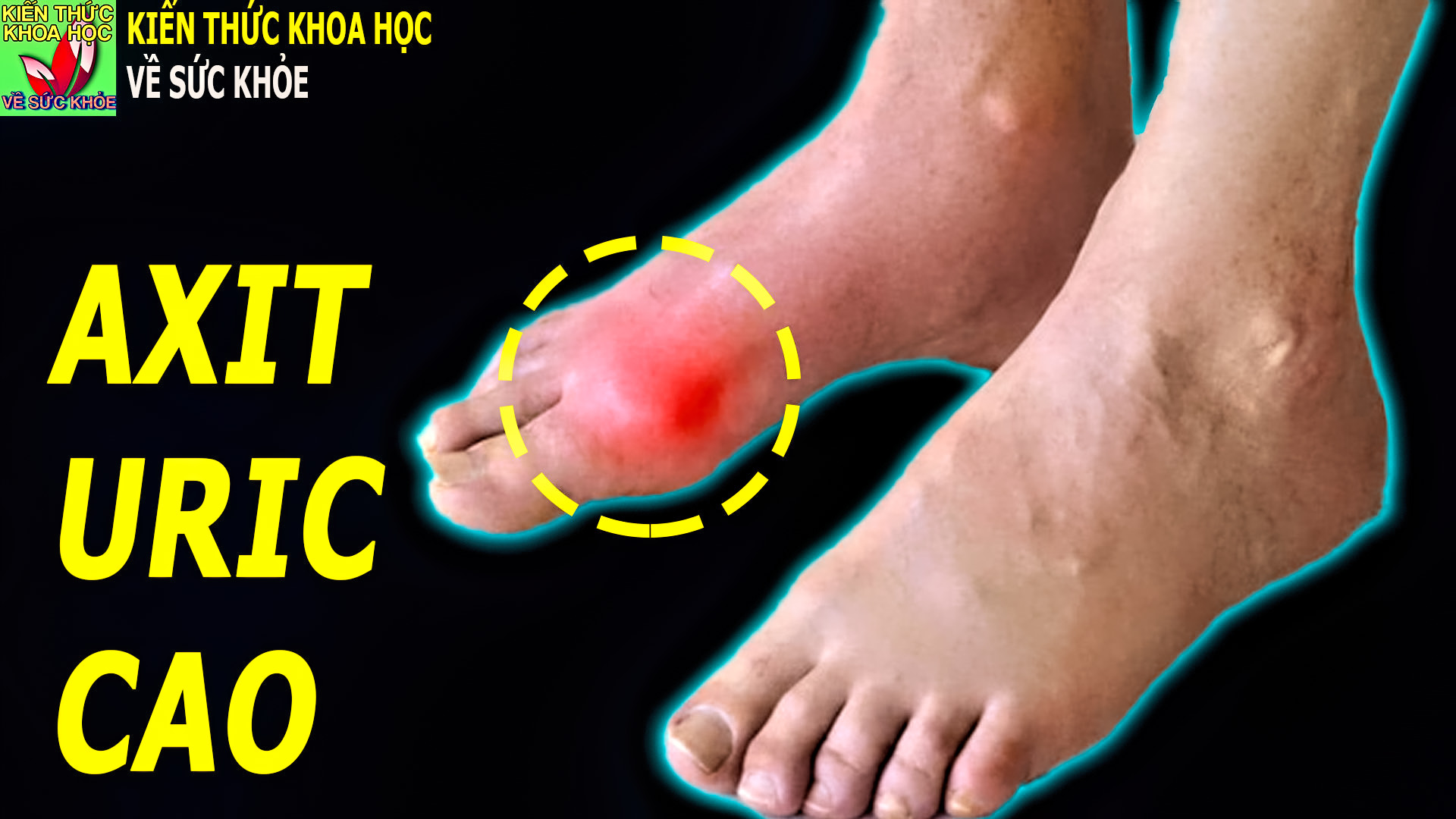 than-bi-teo-chan-sung-dau-nhuc-chi-vi-an-uong-sai-cach