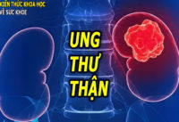dau-hieu-trieu-chung-ung-thu-than