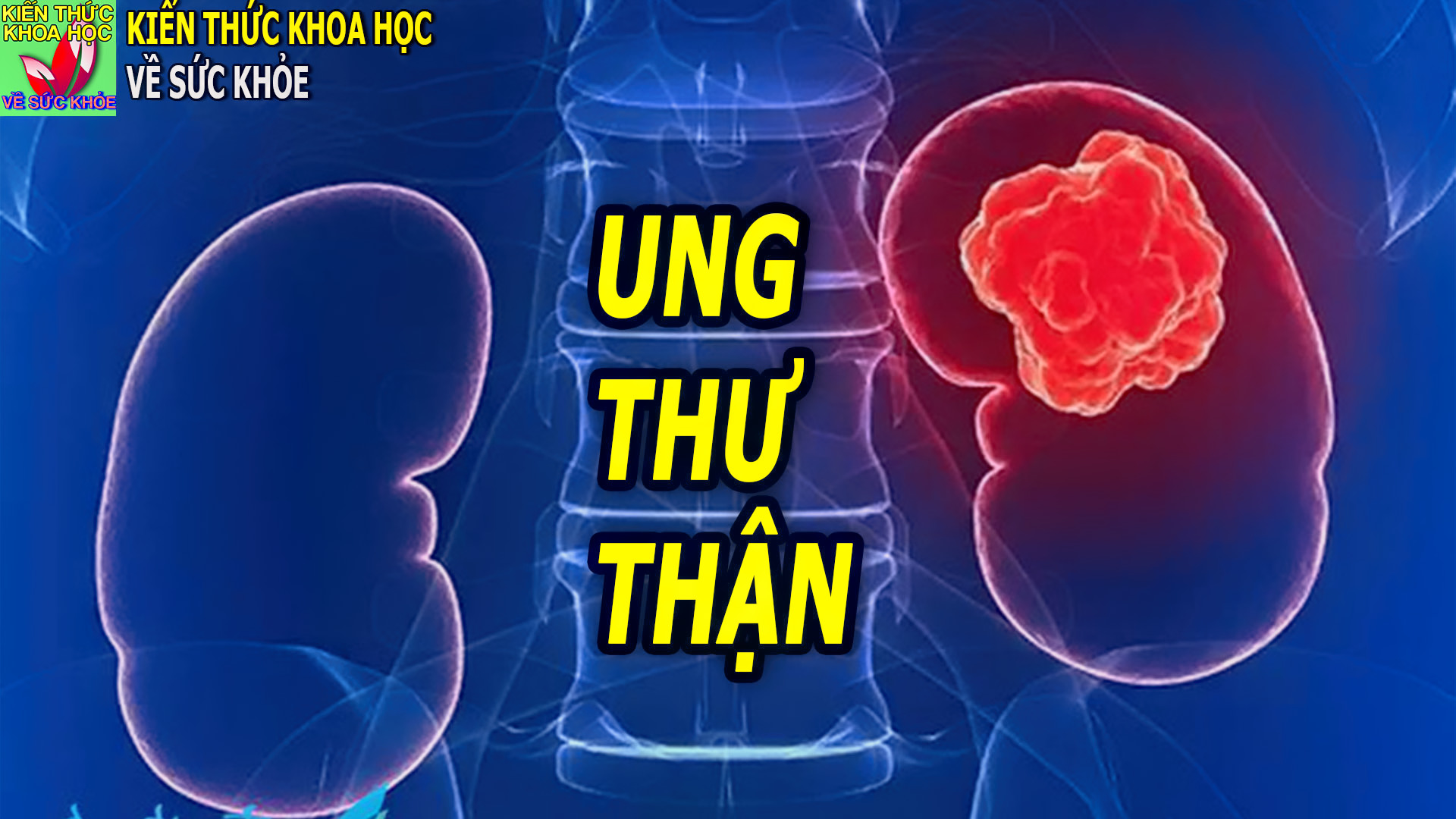 dau-hieu-trieu-chung-ung-thu-than