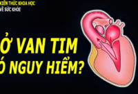 ho-van-tim-nguyen-nhan-trieu-chung-va-cach-dieu-tri