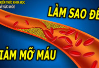 cach-giam-mo-mau-hieu-qua-nhat